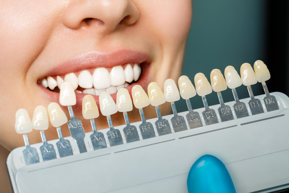 How Much Does Professional Teeth Whitening Cost?