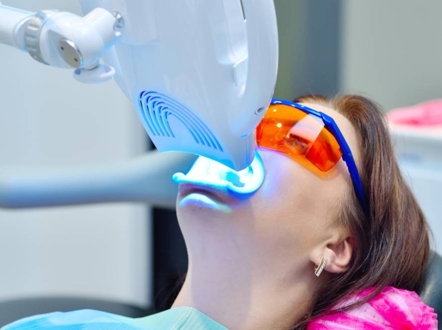 Is In-Office Teeth Whitening Right For You?