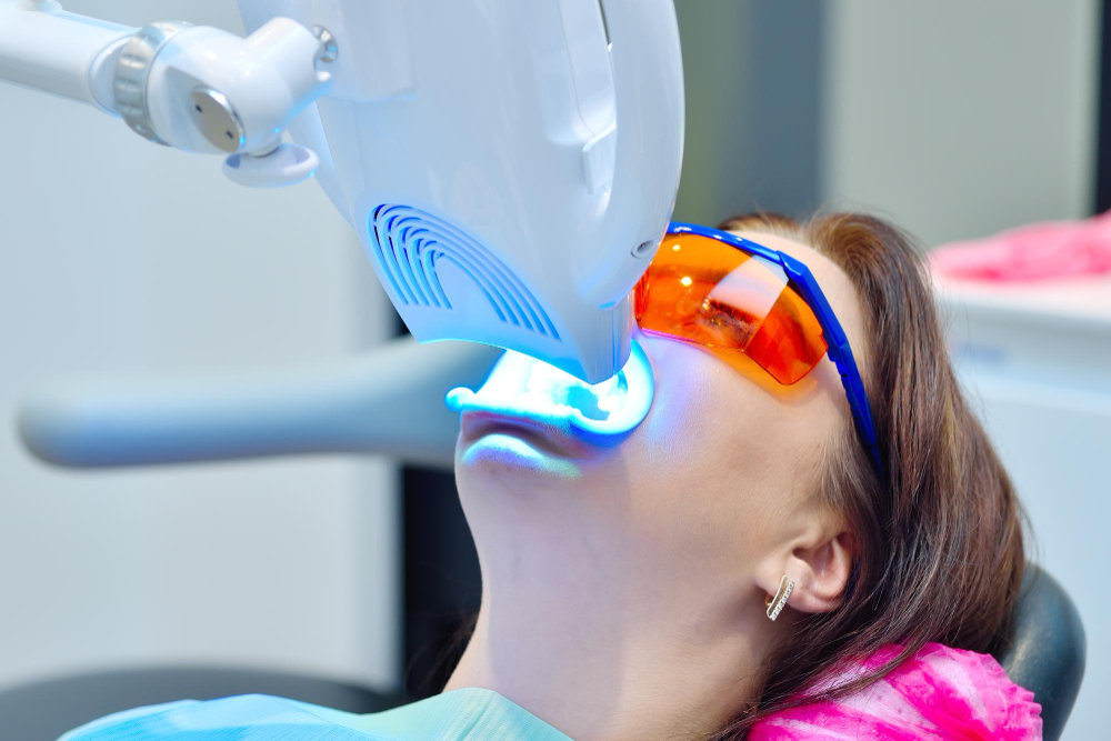 Is In-Office Teeth Whitening Right For You?
