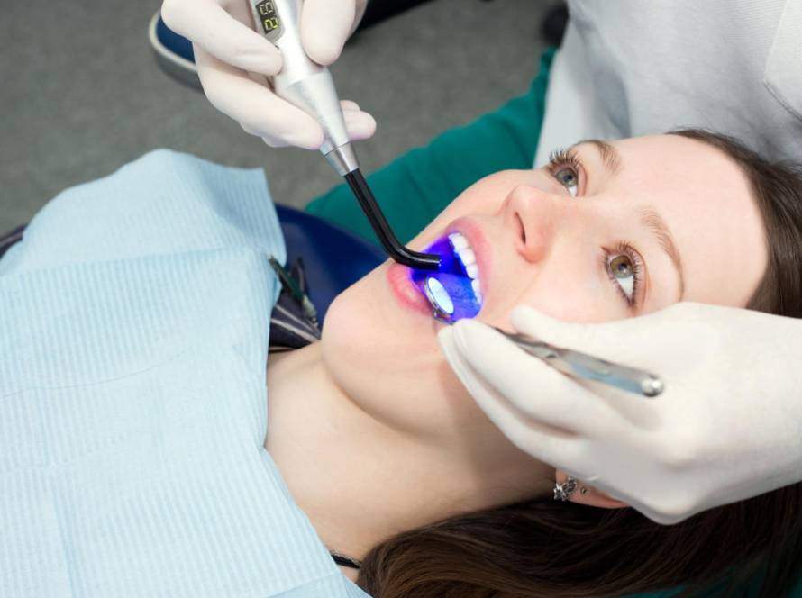 Top Benefits Of Professional Teeth Whitening You’ll Notice Right Away