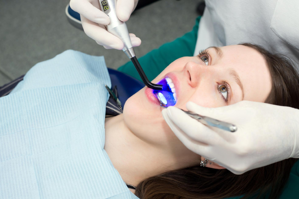 Top Benefits Of Professional Teeth Whitening You’ll Notice Right Away