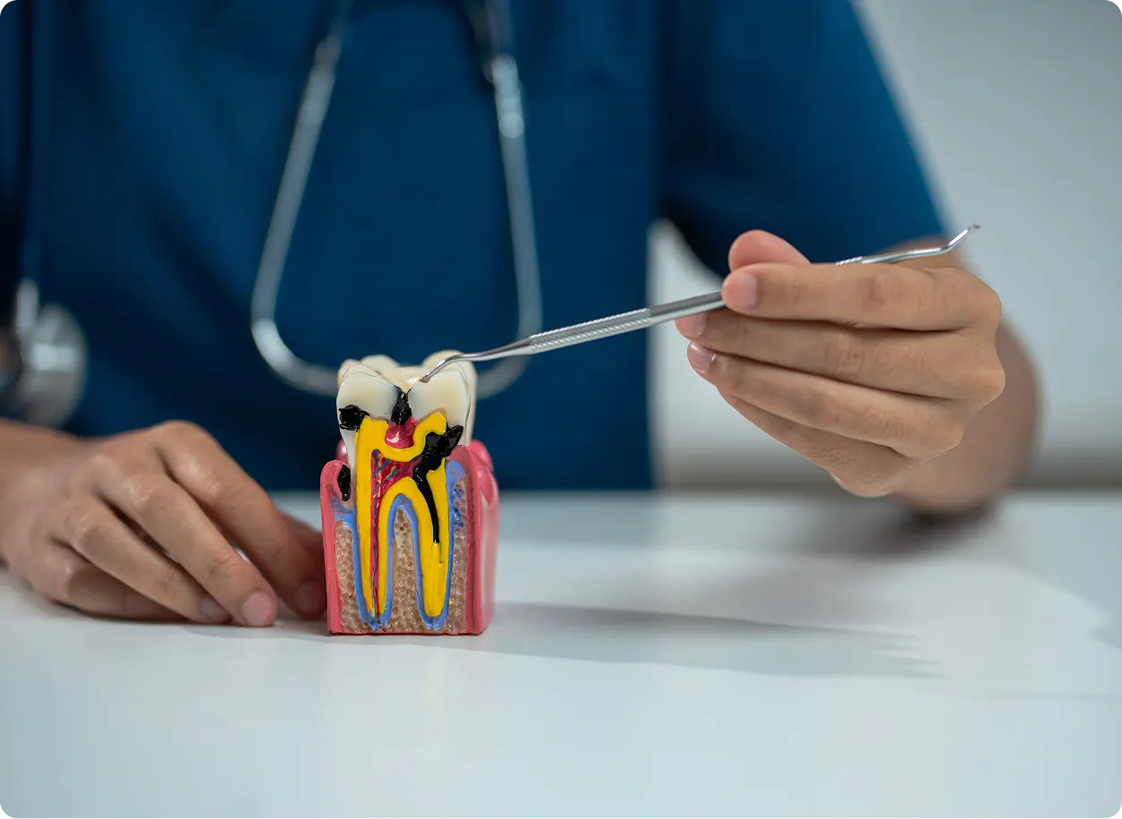 Dental professional explains root canal on tooth