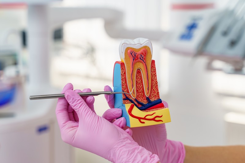 The Differences Between A Surgical And Non-Surgical Root Canal